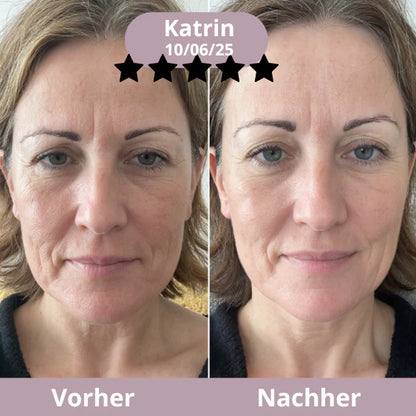 Stick antiarrugas con calcio – Rejuvenece y reafirma el rostro Fórmula con calcio + colágeno y complejo Ribornic patentado